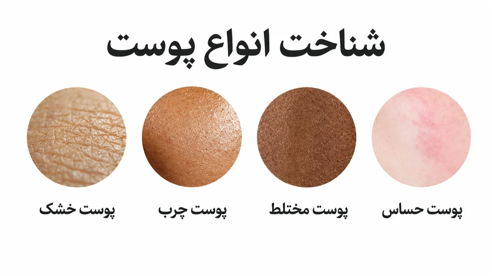 شناخت انواع پوست